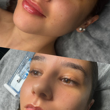 Юлія Кондратюк, Ровно Фото - 5