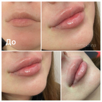 Елена Самохина, Харьков Фото - 10