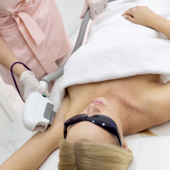 Elos лазерна епіляція