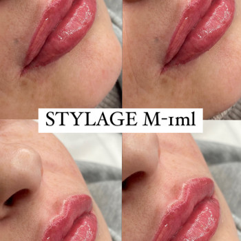 Елена Самохина, Харьков Фото - 23