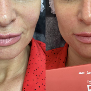 Елена Самохина, Харьков Фото - 25