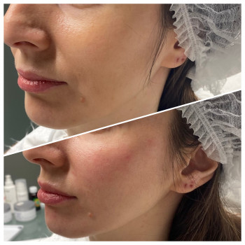 Елена Самохина, Харьков Фото - 26