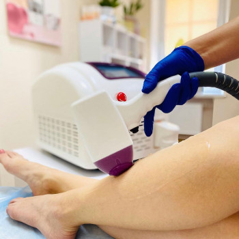 Лазерна епіляція на діодному лазері з підтвердженою результативністю. 1000+ позитивних відгуків кліє...