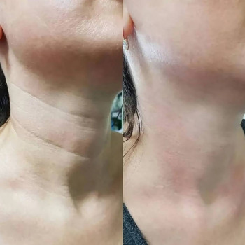 Марина Пилипович, Чернигов Фото - 5