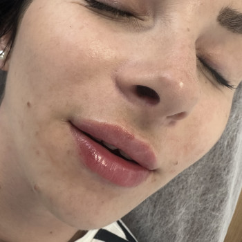 Натуральні губки заживші 0,6 препарату