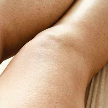 Фото ніг «після» воскової депіляції 
 