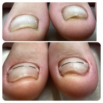 Олена Шибанова, Черкаси Фото - 31