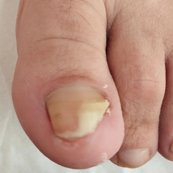 Педикюр з гель-лак
                    Мастер маникюра Анастасія Ужгород