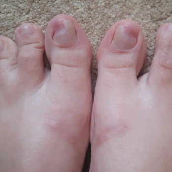 Педикюр з гель-лак
                    Мастер маникюра Анастасія Ужгород