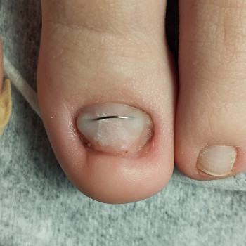 Педикюр з гель-лак
                    Мастер маникюра Анастасія Ужгород