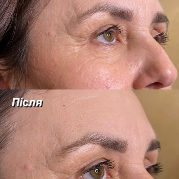 Анна Кондратова, Днепр Фото - 6