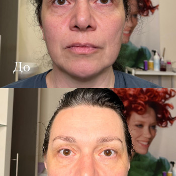 Анна Кондратова, Днепр Фото - 11