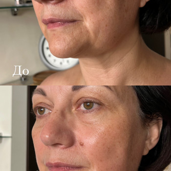 Анна Кондратова, Днепр Фото - 15