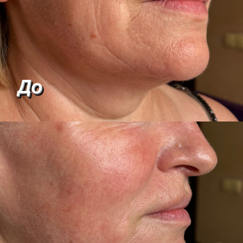 Анна Кондратова, Днепр Фото - 21