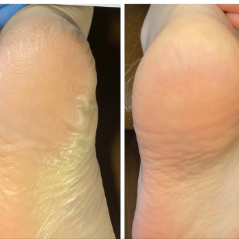 Relax, Броди Фото - 15