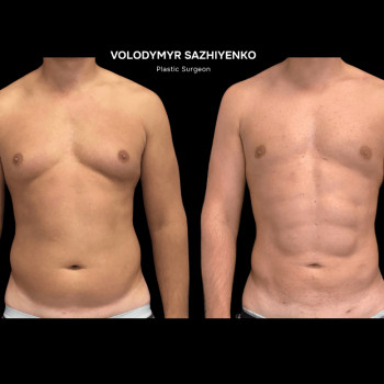 Владимир Сажиенко, Киев Фото - 6