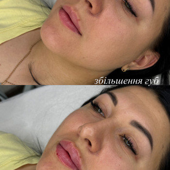 Діана Коваль, Харьков Фото - 5