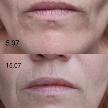 Вікторія Хоменко, Боярка Фото - 5