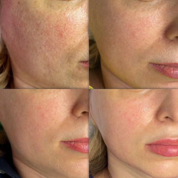 Александра Кулица, Одесса Фото - 30