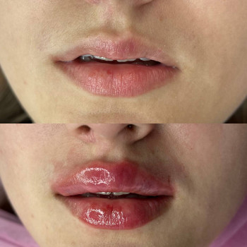 Александра Кулица, Одесса Фото - 17