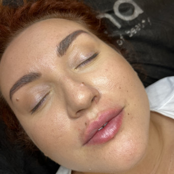 Контурна пластика губ
                    Врач-косметолог Ирина Краматорск