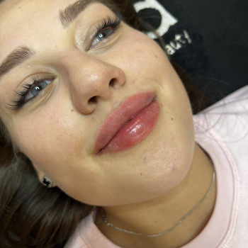 Контурна пластика губ
                    Врач-косметолог Ирина Краматорск