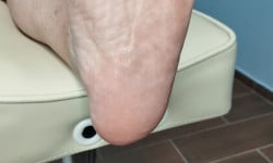 Гигиенический педикюр без покрытия Подолог Алена Горишние Плавни