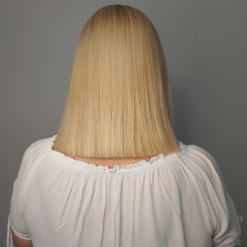 Після процедури.
робили Реконструкцію тотальне відновлення.