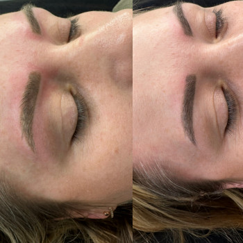 Видалення лазером
                    Мастер перманентного макияжа Людмила Бровары