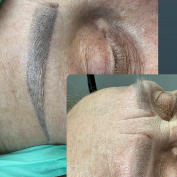 Видалення лазером
                    Мастер перманентного макияжа Людмила Бровары