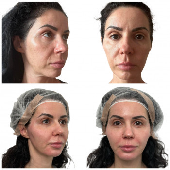 Ліана Іваненко, Запоріжжя Фото - 7