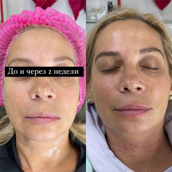 Ліана Іваненко, Запоріжжя Фото - 8