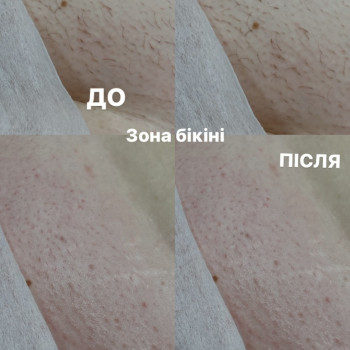 Ирина Лившук, Полтава Фото - 7