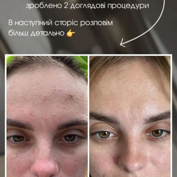 Фото з портфоліо косметолога Єлизавета Закалічна (Київ)