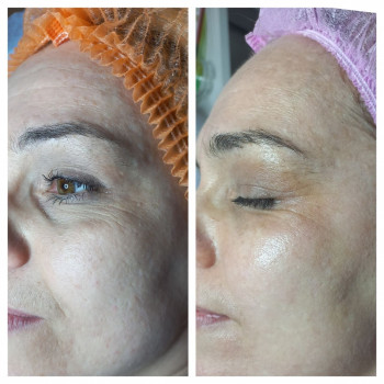 Юлия Мельничук, Львов Фото - 5