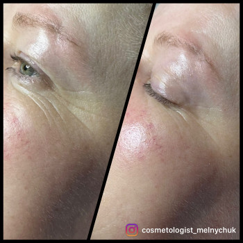 Юлия Мельничук, Львов Фото - 6