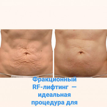 Наталия Павлова , Одесса Фото - 7