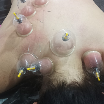 Кирил Глопін, Черновцы Фото - 4