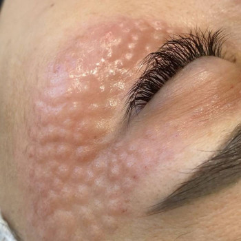 Олена Приймак, Киев Фото - 10