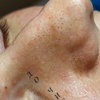 Олена Приймак, Киев Фото - 11