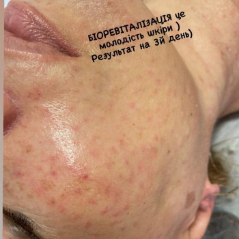 Олена Приймак, Киев Фото - 15