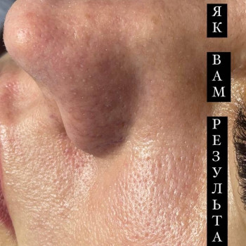 Олена Приймак, Киев Фото - 18