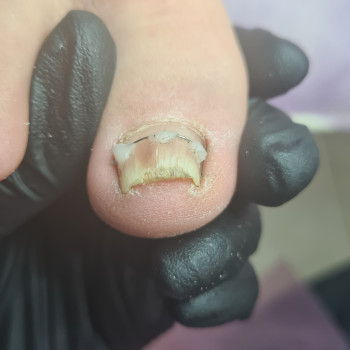 Тетяна Петрова, Чорноморськ Фото - 5