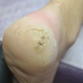 Тетяна Петрова, Чорноморськ Фото - 7