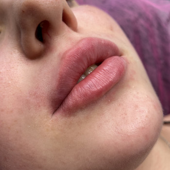 Юлія Медвєдєва, Луцьк Фото - 2