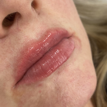 Юлія Медвєдєва, Луцьк Фото - 5