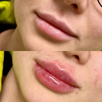 Юлія Медвєдєва, Луцьк Фото - 9