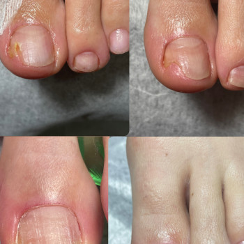 Юлія Симонец, Ірпінь Фото - 27