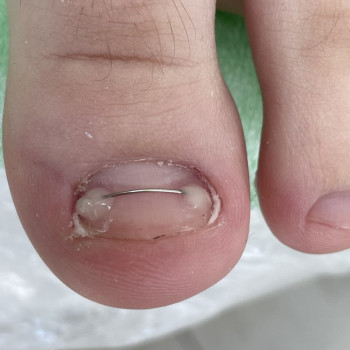 Юлія Симонец, Буча Фото - 17