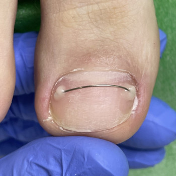 Юлія Симонец, Буча Фото - 21